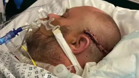A man in a hospital bed with breathing apparatus on his face