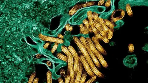 Colorised transmission electron micrograph of Ebola virus particles (in gold) with other cells in green
