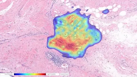 David Bailey Breast cancer scan image