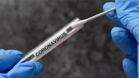 Getty Images Coronavirus swab