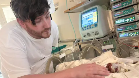 Family handout Anthony is standing over an incubator where Levi is attached to medical equipment including a breathing tube.  
