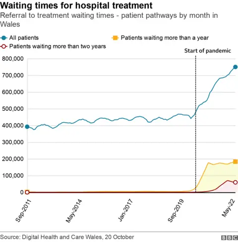 Longest waits chart