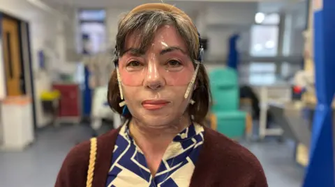 BBC A woman with burns injuries to her face is wearing a clear, plastic mask and looking at the camera. She has shoulder length hair and is wearing a burgundy cardigan over a white and blue top. She's sitting in a medical room in a hospital.