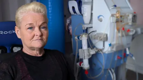 Woman with short blonde hair and a dark top, looking at cameram with a blue and white dialysis machine in the background.