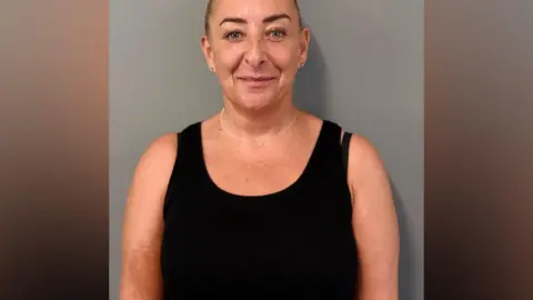 A middle aged woman, standing against a plain grey wall, smiles into the camera. She had blonde hair tied back and is wearing a black vest-top. On her right arm a large, light-brown birthmark is visible just above the crook of her elbow.
