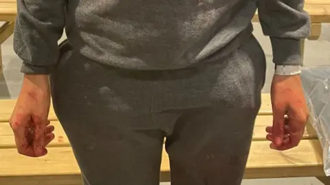 Photos from inside Manston show the migrant's hands covered in blood