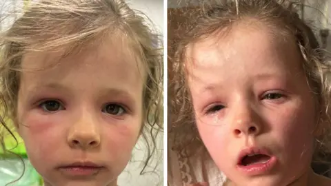 Submitted A split screen with two images of Margo. She has red, swollen eyes in the picture on the right, on the left she also has red, swollen eyes but looks less distressed.