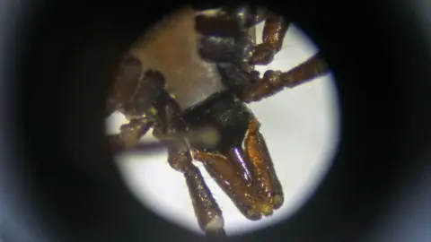 BBC/Emma Lynch View of tick's mouth as seen through a microscope