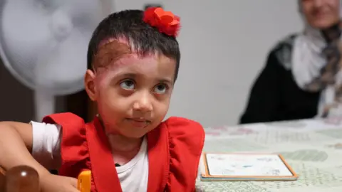 BBC Zeina sits at a table in a red dress; an injury to the skin on her head is visible