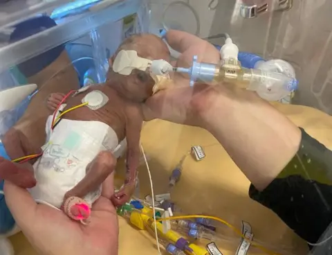 Jade Crane One of the twins in an incubator