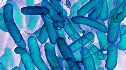  James Cavallini/Science Photo Library E.coli bacteria / bacterium magnified in microscopic view