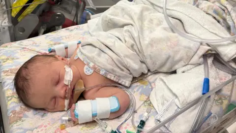 Jade Arwell is lying in a hospital crib, partially wrapped in a patterned blanket. The baby has a breathing tube and monitoring devices attached to his hands and chest. A large monitor above shows heart rate and other vital signs, with additional medical equipment in the background.