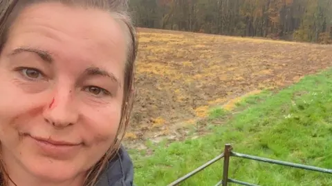 Sammi Allen A woman with a scratched face in a field