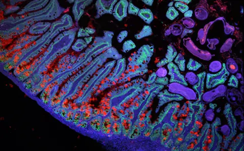 Grace Burgin, Noga Rogel & Moshe Biton, Klarman Cell Observatory, Broad Institute.png A section showing how many genes are turned on to develop the lower intestine.