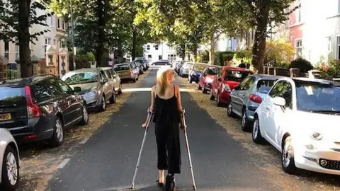 Gina Paletta On crutches last summer
