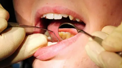 PA File photo: Close up of a dentist examining a patient's teeth