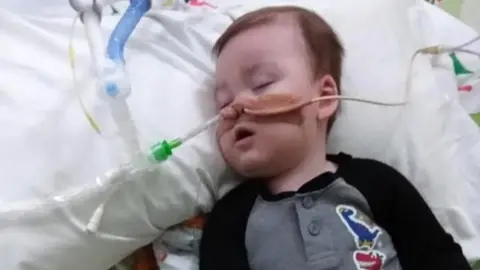 Family/Alfie's Army Alfie in hospital