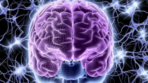 Science Photo Library Electric brain