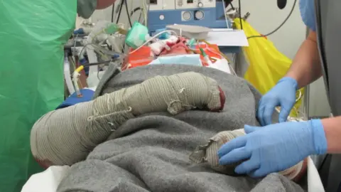 JJ Chalmers JJ Chalmers injured in Afghanistan