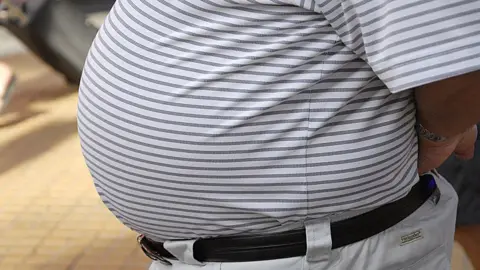 Getty Images Image of a man's obese belly, taken on 19 July 2014