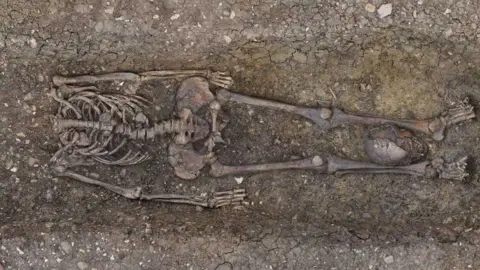 HS2 Roman decapitated skeleton, Fleet Marston