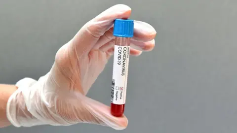 Getty Images test tube with covid blood sample