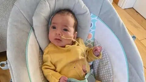Caroline Lambert A baby wearing a yellow baby grow with a giraffe looks up at the camera. She has a feeding tube in her nose.