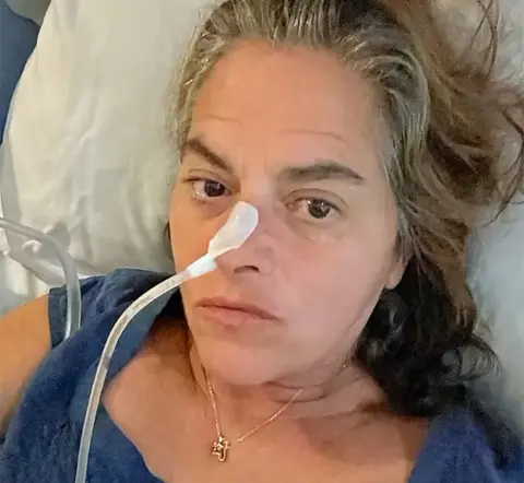 Tracey Emin Tracey Emin with a medical tube attached to her nose