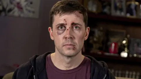ITV/Coronation Street Gareth Pierce as Todd Grimshaw in the purple-themed stylistic episode - he has a black eye and wears a purple t-shirt.