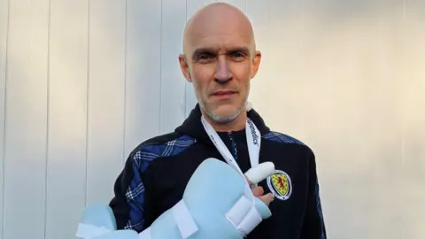 Louise Blyth A bald man with light grey stubble holding up his heavily bandaged finger. he is wearing a blue Scotland tracksuit top.