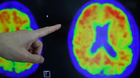 A hand is pointing at two colourful brain scan images displayed on a screen, showing cross-sections of a human brain. The scans use bright colours like red, yellow, green, and blue to highlight different levels of activity or density.