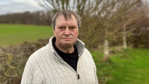 A middle-aged man with a badly burned face, wearing a cream cardigan and black tee-shirt, is looking towards the camera with a garden hedge and fields in the background