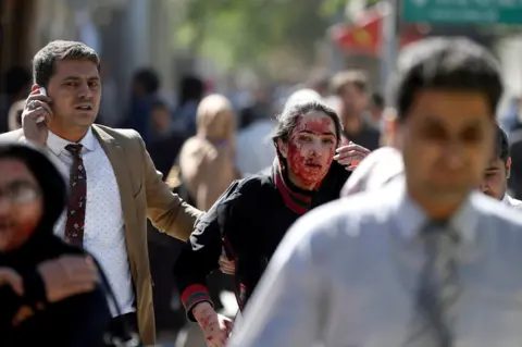 Reuters Injured Afghans run from the site of a blast in Kabul, Afghanistan 31 May 2017.