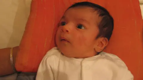 Geeta Nayar Baby Maya is lying on an orange pillow, wearing a white baby-grow. She still has the marks on her face from a forceps delivery.