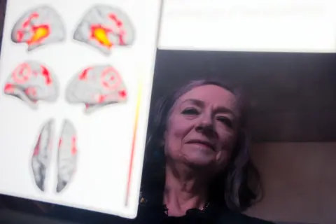 Laurence Cawley/BBC Prof Scott reflected on the screen of a computer which shows scans of brains revealing the various areas of the brain activated by laughter