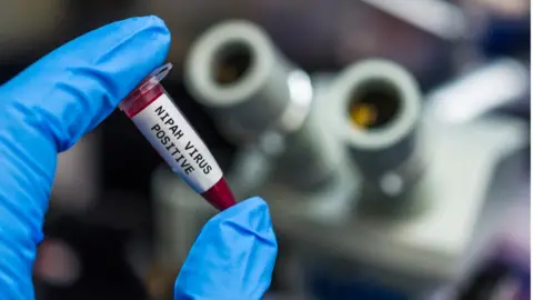 Getty Images Nipah virus positive blood sample - stock photo