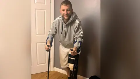 Avenue Hotspur Joel Collins, who was attacked after a football game, smiles as he stands in a home on two crutches with a cast on his leg. 