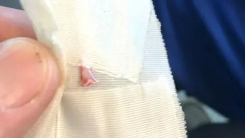 Reuters A photo of what appears to be a shark's tooth extracted from the leg of a 13-year old boy, who was attacked at Atlantique Beach in Islip, New York, 18 July 2018