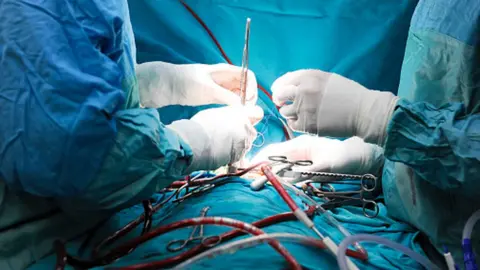 Getty Images Heart surgery