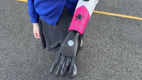 There is a close-up of Zoe's bionic arm. The hand and fingers are black, with a spider and web design on the forearm on a pink background