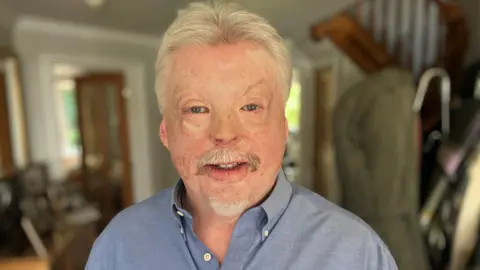 Simon Weston