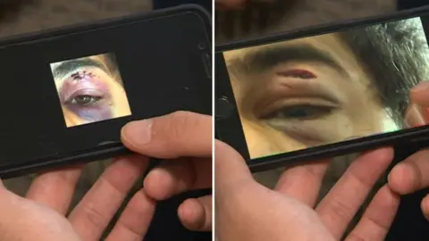 Photos of Shiv's injuries