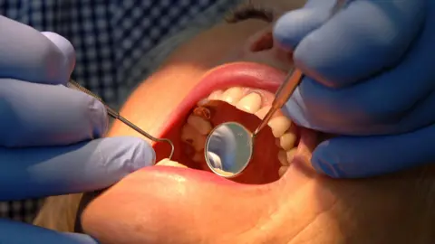 PA Media A dental examination taking place. A pair of hands wearing blue gloves holding dental implements over a patient's open mouth.
