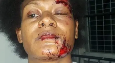 De'Bono Paraka Facebook Debbie Kaore with injuries