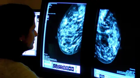 PA Media A woman with dark hair to the left of frame is looking at two screens which are displaying images of a mammogram 