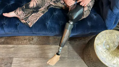 Sue Greenwood's prosthetic leg. She is sat on a blue velvet sofa. Her left leg has been amputated and she has a metal prosthetic. Her right leg rests on a blue sofa. She is wearing leaf print trousers and there is a wooden floor with a gold coffee table.