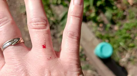 Gabriela Thomas Gabriela Thomas hand with a scratch on and her coffee cup can be seen on the floor.