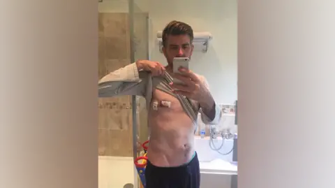 Phil Alderson A man holds his top up to show a bloody bandage on his left nipple, in a bathroom
