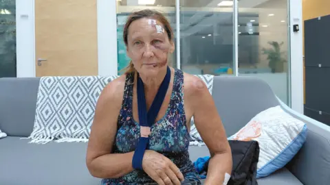 A woman sitting on a grey sofa wearing a blue tank top, with her right arm in a navy blue sling. She has bruising on her face and stitches on her head.