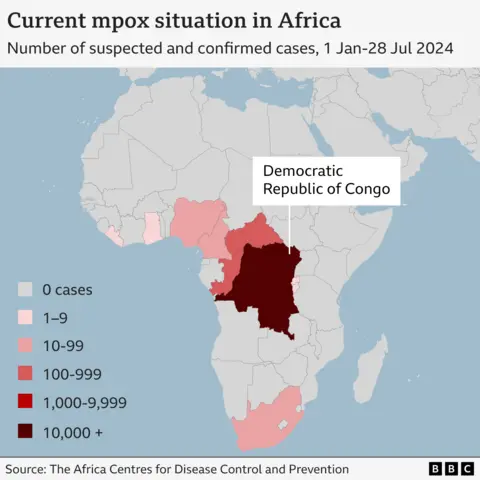 What is mpox, what are the symptoms and which countries is it in?